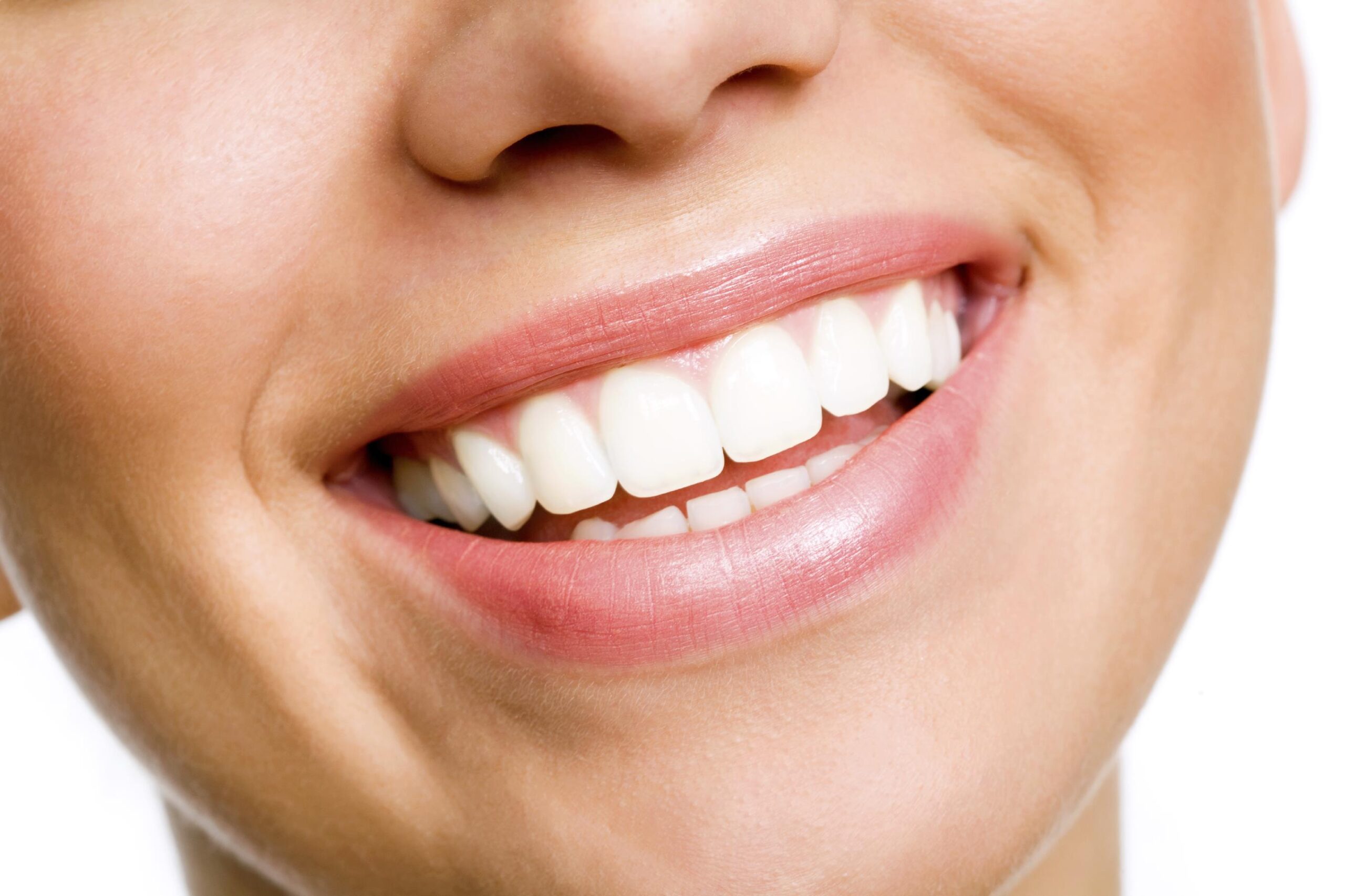 8 Amazing Benefits of Professional Teeth Whitening