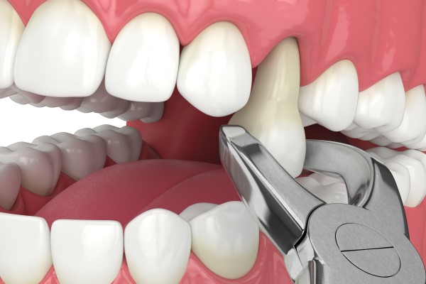 Suffering From Gum Swelling? These Are Signs That You Need to Take Them Seriously!