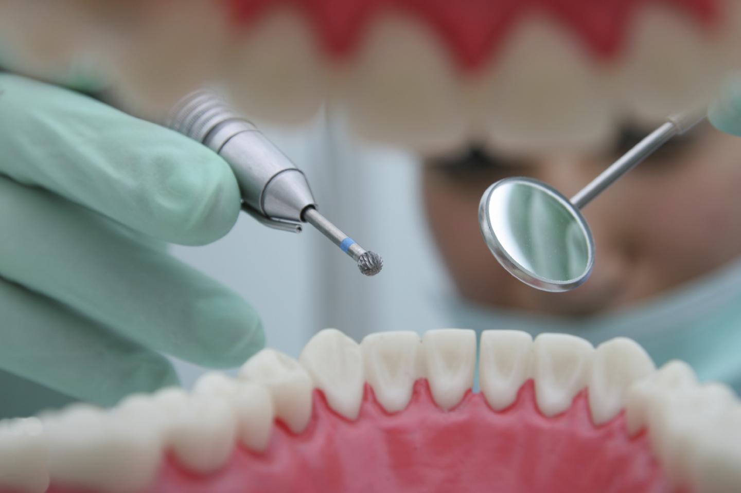 Why Do Some People Have Spots in Their Teeth from Fluoride?