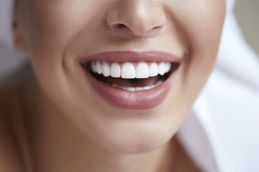 Most Common Cosmetic Dental Treatments and Their Benefits 