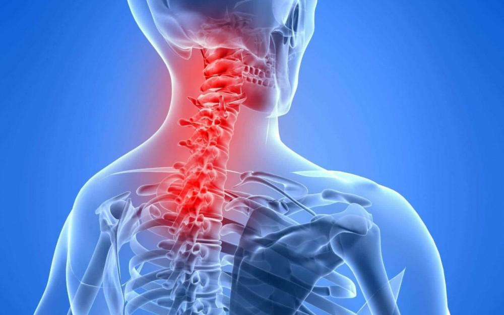 Can Stress Cause Neck Pain?