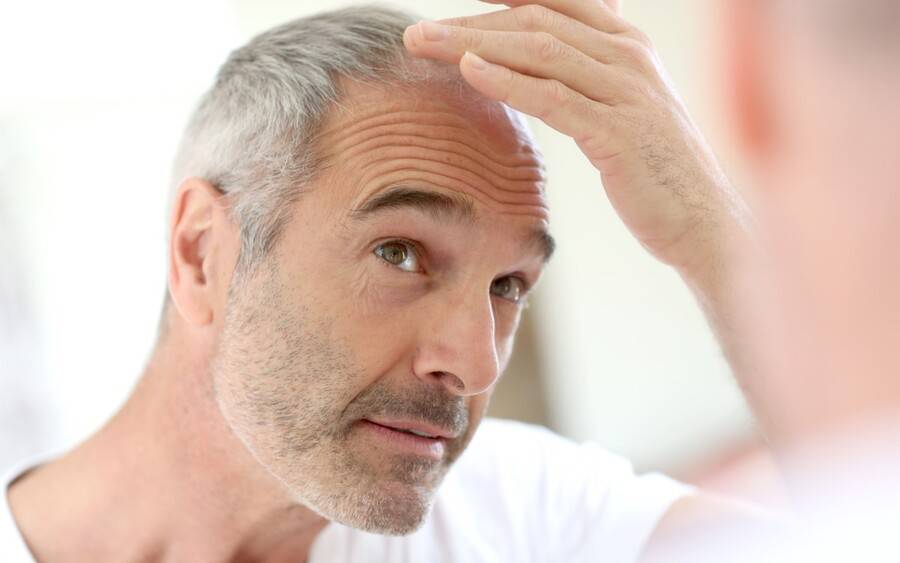 Addressing Hair Fall: A Comprehensive Overview of Available Treatments