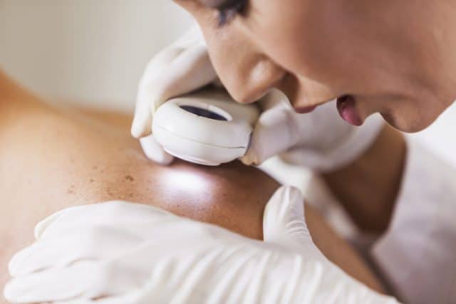 The Importance of Regular Dermatologist Check-ups for Skin Cancer Prevention