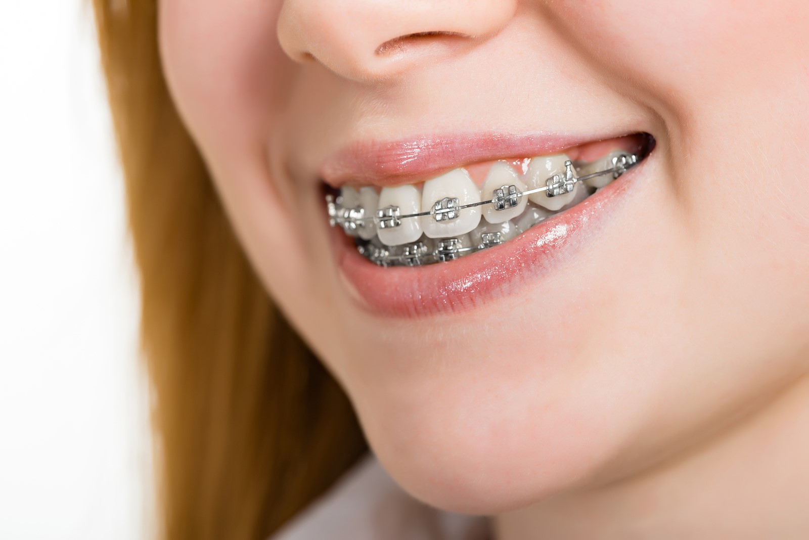 Orthodontics: More Than Just Aesthetics