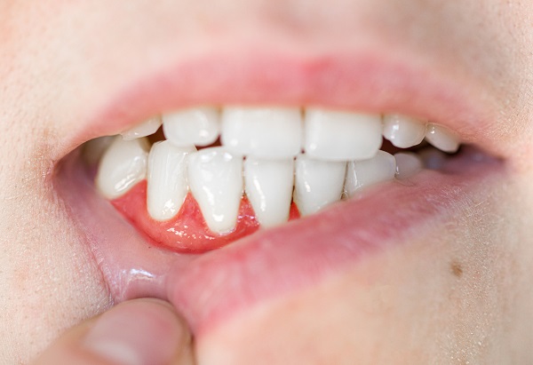 How A Periodontist Can Improve Your Smile