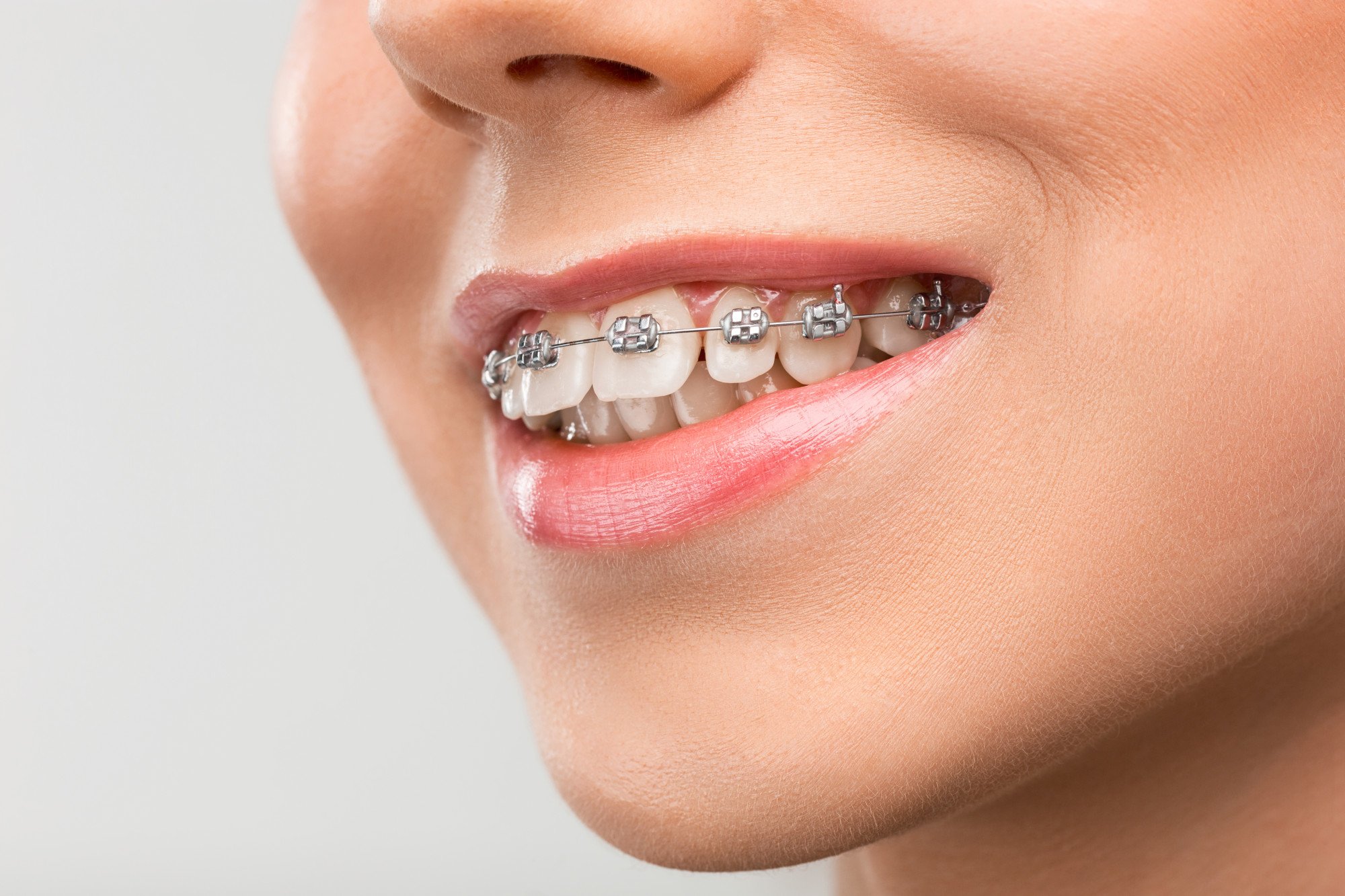 7 Reasons why dentists recommend Orthodontic treatment