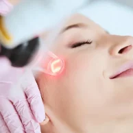 Acne Scar Treatment