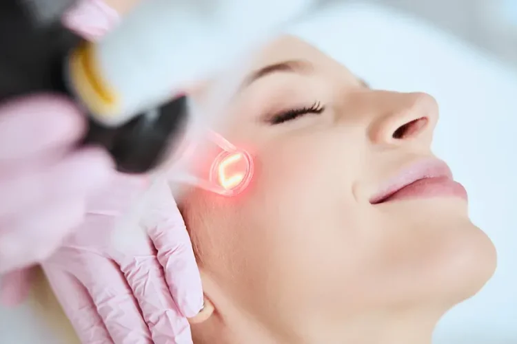 Acne Scar Treatment