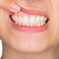 How Periodontal Care Helps Prevent Tooth Loss